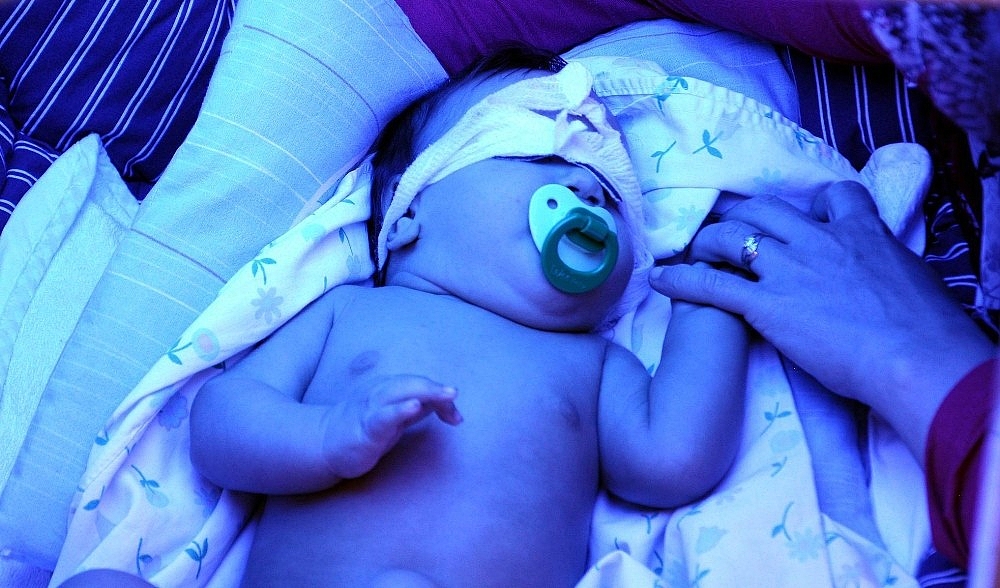 Önce 20 kilo verdi, sonra oğluna karaciğerini verdi
