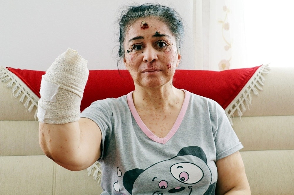 Güneşin erittiği kadın!