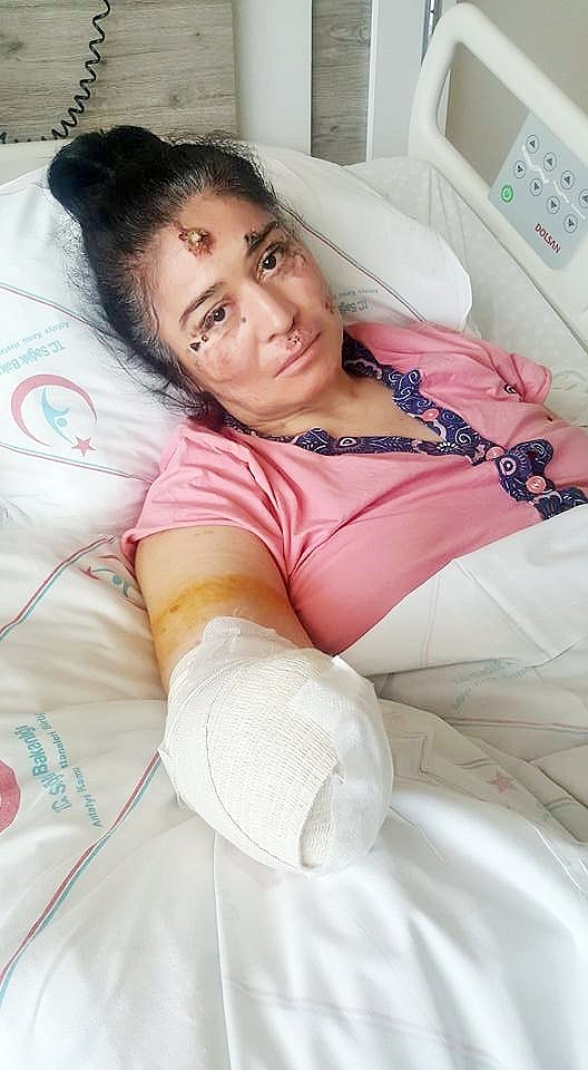 Güneşin erittiği kadın!
