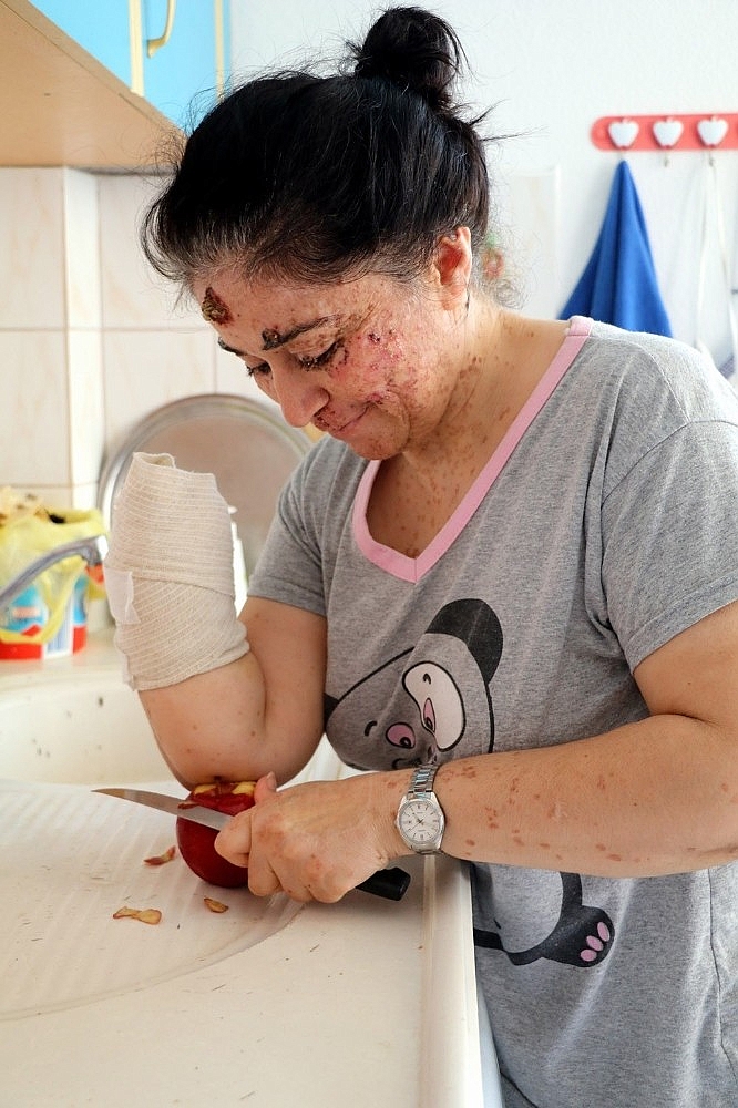 Güneşin erittiği kadın!